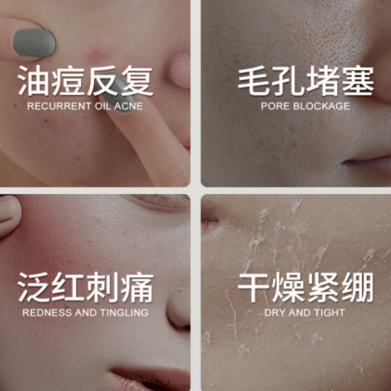 Centella Asiatica Salicylic Ac - Salicylic Acid Blackhead Remover 评论和价格